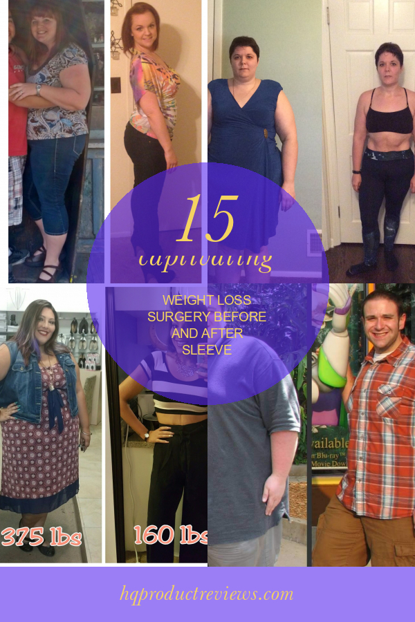 15 Captivating Weight Loss Surgery Before And After Sleeve Best Product Reviews 0374